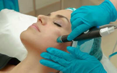 Rejuvenecimiento Facial sin Agujas en Alcalá