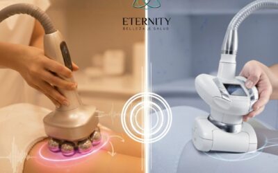 Rollaction vs. LPG: ¿Cuál es el Tratamiento Corporal que Necesitas para la Celulitis en Alcalá?