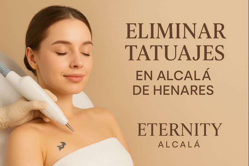 eliminar-tatuajes-alcala-precios-laser
