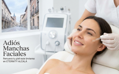 Eliminar Manchas en la Cara en Alcalá de Henares